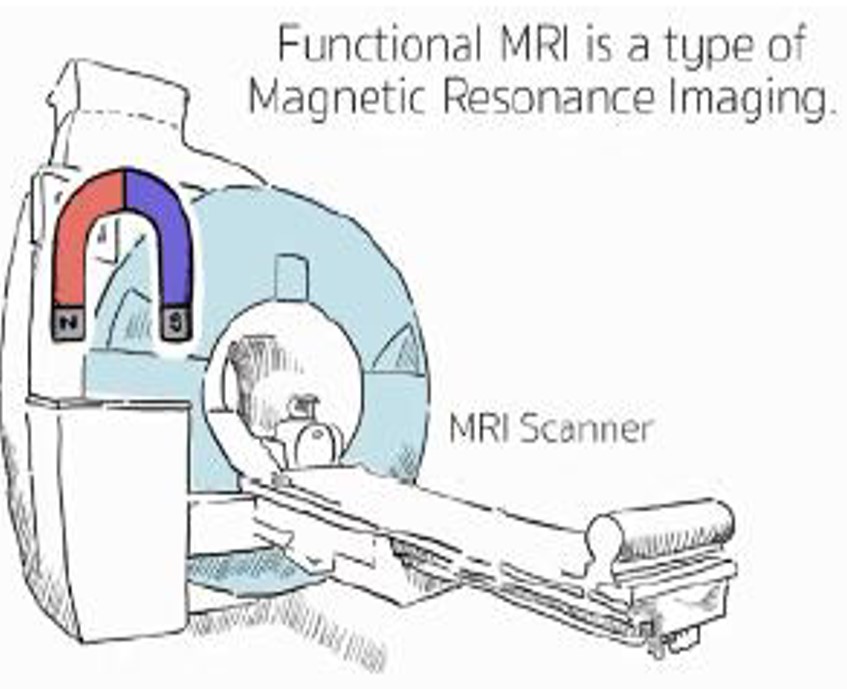 Understanding MRI: A co-creation project to develop an animation with research participants image